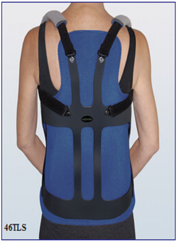 Thoracic Lumbar Sacral Orthosis Knight Taylor Type (TLSO)